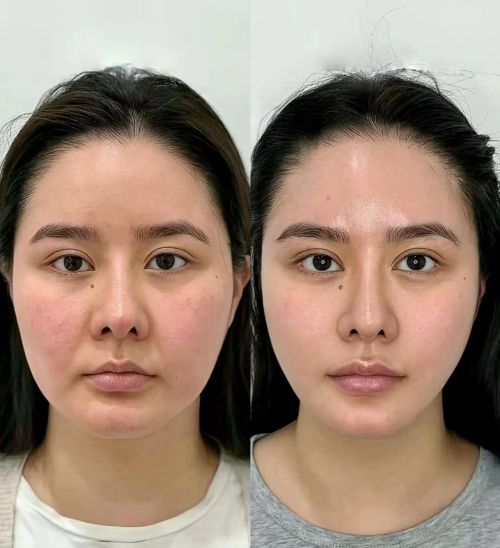 抗皱好的护肤品推荐去皱化妆品名单必一体育